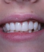 orthodontist-services-1-2