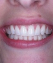 orthodontist-services-1-3