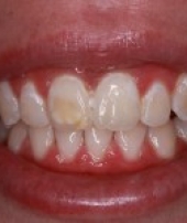 orthodontist-services-3-3